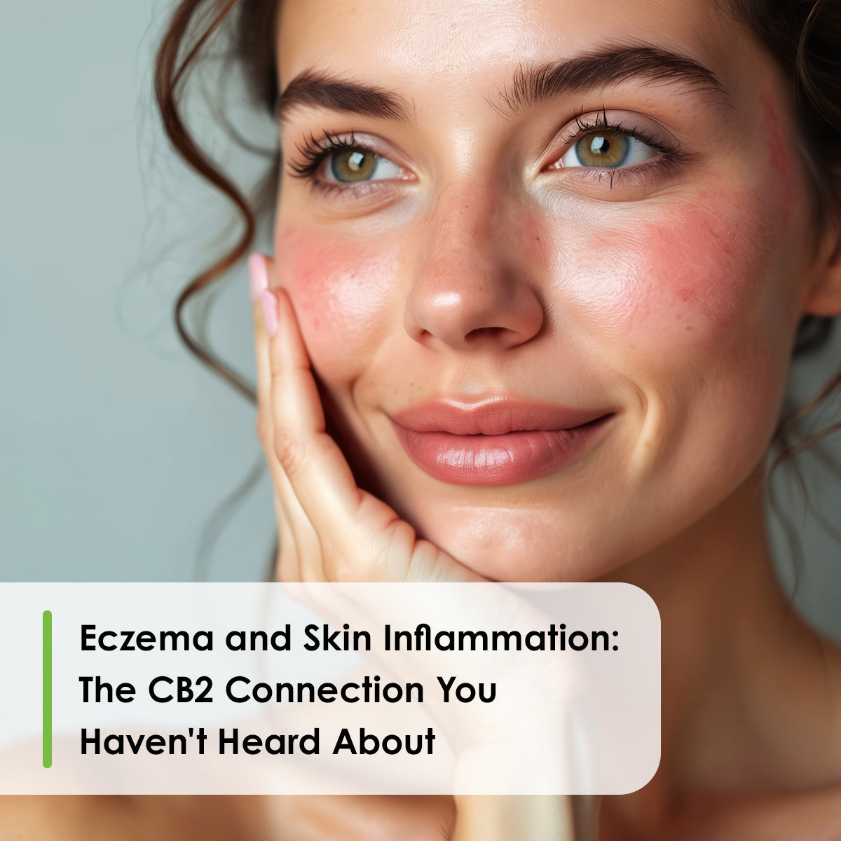 Smiling brown-haired girl with rosacea: CB2 oil beta-caryophyllene for skin inflammation